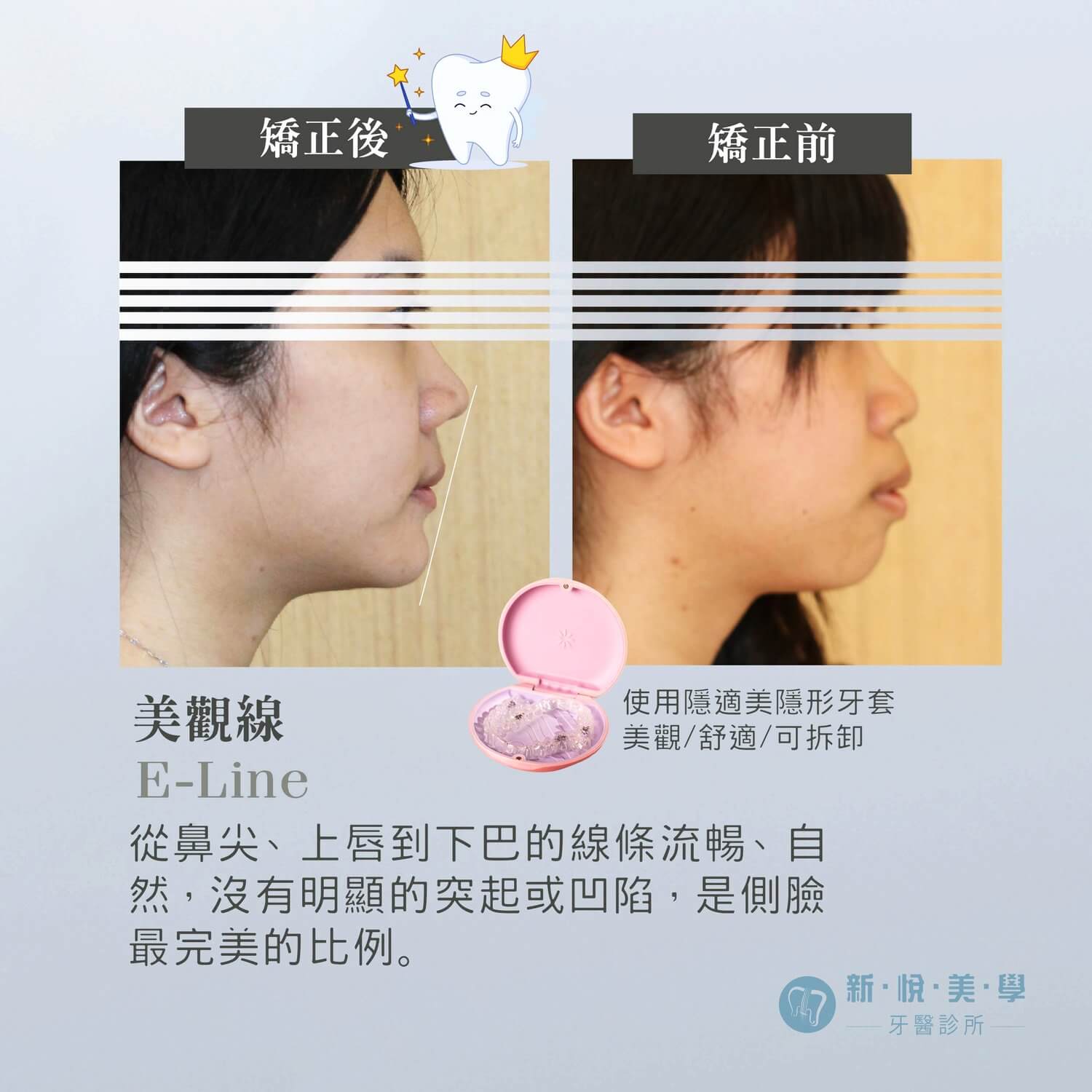 趁早開始，就醫定會改變的第3張圖片